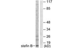 Western blot analysis of extracts from A549 cells, using Stefin B Antibody. (CSTB Antikörper  (AA 49-98))