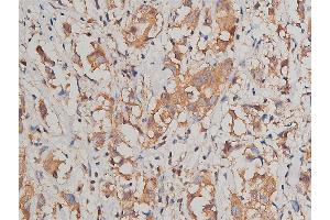 Immunohistochemistry (IHC) image for anti-Junction Plakoglobin (JUP) (C-Term) antibody (ABIN6260497)