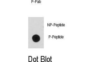 Image no. 2 for anti-BCL2-Associated Agonist of Cell Death (BAD) (pSer99) antibody (ABIN358087) (BAD Antikörper  (pSer99))