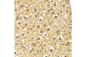 Immunohistochemistry of paraffin-embedded mouse liver using PYCARD antibody at dilution of 1:100 (400x lens). (STS Antikörper)