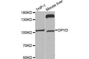 Western blot analysis of extracts of various cell lines, using DPYD antibody. (DPYD Antikörper  (AA 1-173))
