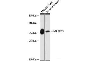 Western blot analysis of extracts of various cell lines using MAPRE3 Polyclonal Antibody at dilution of 1:3000. (MAPRE3 Antikörper)