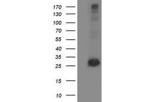 Western Blotting (WB) image for anti-Sirtuin 5 (SIRT5) antibody (ABIN1500931) (SIRT5 Antikörper)