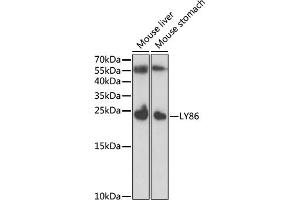 Western blot analysis of extracts of various cell lines, using LY86 antibody (ABIN6128208, ABIN6143395, ABIN6143396 and ABIN6221778) at 1:1000 dilution. (LY86 Antikörper  (AA 21-162))