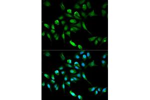 Immunofluorescence analysis of HepG2 cell using ADH5 antibody. (ADH5 Antikörper)