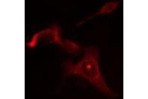 ABIN6275058 staining Hela cells by IF/ICC. (DGAT2L6 Antikörper  (C-Term))