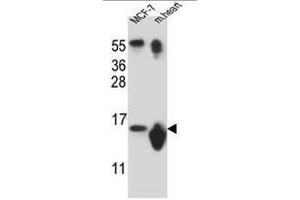 SNRPD3 Antibody (N-term) western blot analysis in MCF-7 cell line ans mouse heart tissue lysates (35µg/lane). (SNRPD3 Antikörper  (N-Term))