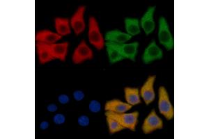 EPHB4 Mouse Monoclonal Antibody staining HepG2 cells by IF/ICC.
