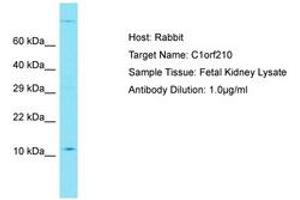 Image no. 1 for anti-Chromosome 1 Open Reading Frame 210 (C1ORF210) (AA 42-91) antibody (ABIN6750765) (C1ORF210 Antikörper  (AA 42-91))