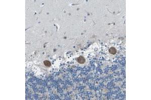 Immunohistochemical staining of human cerebellum with OPALIN polyclonal antibody  shows moderate cytoplasmic positivity in purkinje cells.