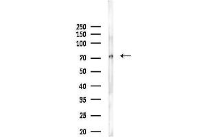 anti-rho GTPase Activating Protein 22 (ARHGAP22) (C-Term) antibody