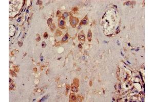 Immunohistochemistry of paraffin-embedded human placenta tissue using ABIN7163916 at dilution of 1:100 (KCNK1 Antikörper  (AA 268-336))