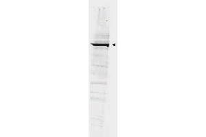 Western blot using  Affinity Purified anti-GGA1 antibody shows detection of bands at ~100 kDa corresponding to YFP-GGA1 fusion present in a lysate of HEK293 cells over- expressing the recombinant protein (arrowhead). (GGA1 Antikörper  (AA 330-360))