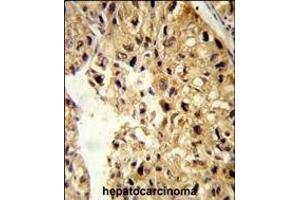 Immunohistochemistry (Paraffin-embedded Sections) (IHC (p)) image for anti-Pterin-4 alpha-Carbinolamine Dehydratase/dimerization Cofactor of Hepatocyte Nuclear Factor 1 alpha (PCBD1) (AA 11-37) antibody (ABIN653056)
