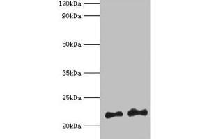 Western blot All lanes: Hras antibody at 2 μg/mL Lane 1: 293T whole cell lysate Lane 2: Mouse brain tissue Secondary Goat polyclonal to rabbit IgG at 1/10000 dilution Predicted band size: 22 kDa Observed band size: 22 kDa (HRAS Antikörper  (AA 2-186))