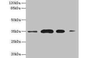 Western blot All lanes: SULT1A3 antibody at 20 μg/mL Lane 1: A549 whole cell lysate Lane 2: Colo320 whole cell lysate Lane 3: Mouse brain tissue Lane 4: Mouse kidney tissue Secondary Goat polyclonal to rabbit IgG at 1/10000 dilution Predicted band size: 35, 23 kDa Observed band size: 35 kDa