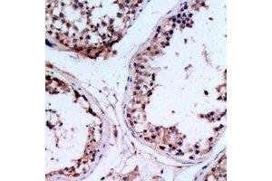 Immunohistochemical analysis of CHST9 staining in human testis formalin fixed paraffin embedded tissue section. (CHST9 Antikörper  (C-Term))