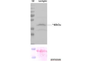 Sample preparation and immunoblot analysis were carried out as described in Karnik et al. (YFP Antikörper  (C-Term))