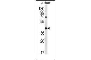 Western blot analysis of Galectin-4 Antibody (N-term) in Jurkat cell line lysates (35ug/lane).