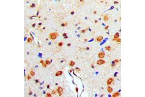 Immunohistochemical analysis of TAU (pT529) staining in human brain formalin fixed paraffin embedded tissue section. (tau Antikörper  (pSer529))