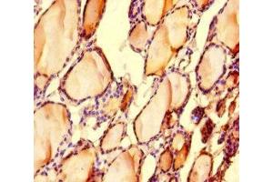 Immunohistochemistry of paraffin-embedded human thyroid tissue using ABIN7158488 at dilution of 1:100 (LONP1 Antikörper  (AA 614-959))