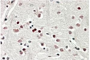 AP20177PU-N SOX3 Antibody staining of paraffin embedded Human Cerebral Cortex at 3. (SOX3 Antikörper  (C-Term))