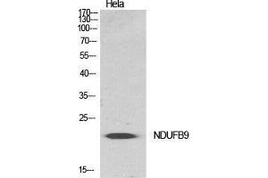 Western Blot (WB) analysis of specific cells using NDUFB9 Polyclonal Antibody.
