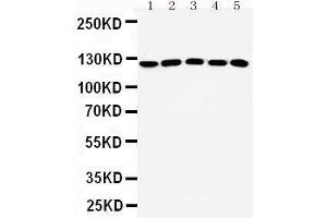 Western Blotting (WB) image for anti-Suppression of Tumorigenicity 5 (ST5) (AA 571-586), (Middle Region) antibody (ABIN3042548) (ST5 Antikörper  (Middle Region))