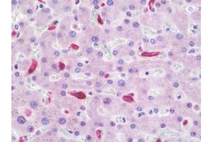 Anti-CD163 antibody IHC staining of human liver. (CD163 Antikörper)