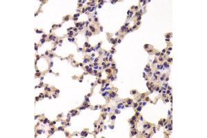 Immunohistochemistry of paraffin-embedded Mouse lung using PYGL antibody at dilution of 1:100 (x400 lens). (PYGL Antikörper)