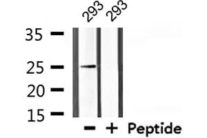 Western blot analysis of extracts from 293, using Claudin 10 Antibody. (CLDN10 Antikörper  (C-Term))