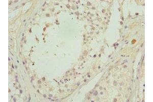 Immunohistochemistry of paraffin-embedded human testis tissue using ABIN7146346 at dilution of 1:100 (CALCOCO1 Antikörper  (AA 462-691))