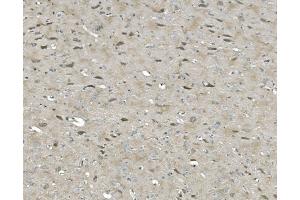 IHC analysis of ULK1 using anti-ULK1 antibody (ABIN7602755). (ULK1 Antikörper  (C-Term))