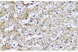 Immunohistochemistry of paraffin-embedded Human liver using NQO2 Polyclonal Antibody at dilution of 1:100 (40x lens). (NQO2 Antikörper)