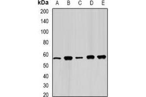 Western blot analysis of FAAH expression in Jurkat (A), Hela (B), mouse kidney (C), PC12 (D), COS7 (E) whole cell lysates. (FAAH Antikörper)