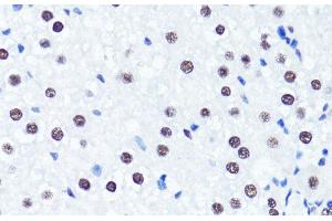 Immunohistochemistry of paraffin-embedded Rat liver using Symmetric DiMethyl-Histone H3-R2 Polyclonal Antibody at dilution of 1:100 (40x lens). (Histone 3 Antikörper  (H3R2me2s))