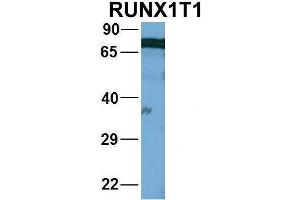 Host:  Rabbit  Target Name:  WT1  Sample Type:  721_B  Antibody Dilution:  1. (RUNX1T1 Antikörper  (Middle Region))
