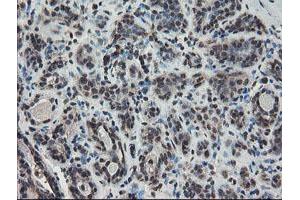 Immunohistochemical staining of paraffin-embedded Human breast tissue using anti-TDO2 mouse monoclonal antibody. (TDO2 Antikörper)