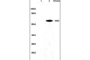 Lane 1: mouse brain lysates Lane 2: human colon carcinoma lysates probed with Anti alpha Actinin PGRN/Granulin Polyclonal Antibody, Unconjugated (ABIN728668) at 1:200 in 4 °C. (Granulin Antikörper  (AA 451-550))