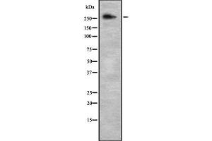 Western blot analysis NCOR2 using NIH-3T3 whole cell lysates (NCOR2 Antikörper  (C-Term))