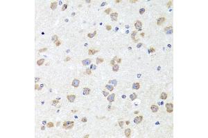 Immunohistochemistry of paraffin-embedded mouse brain using CHD1 antibody (ABIN5975217) at dilution of 1/100 (40x lens). (CHD1 Antikörper)