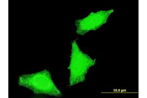 Immunofluorescence of monoclonal antibody to PPP1R2P3 on HeLa cell. (PPP1R2P3 Antikörper  (AA 1-205))