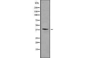 WNT16 Antikörper  (C-Term)