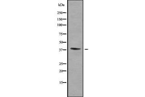 Western blot analysis of WNT16 using Jurkat whole cell lysates (WNT16 Antikörper  (C-Term))