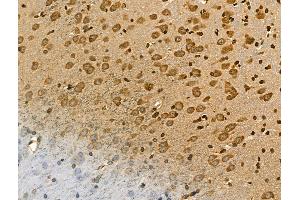 ABIN7094432 and ABIN7098480 at 1/100 staining Rat brain tissue by IHC-P. (ALDH1L1 Antikörper  (C-Term))