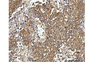 IHC analysis of CBR1 using anti-CBR1 antibody (ABIN7600015). (CBR1 Antikörper  (AA 14-262))
