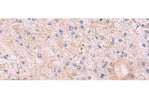 Immunohistochemistry of paraffin-embedded Human tonsil tissue using KANSL1L Polyclonal Antibody at dilution of 1:40(x200) (KANSL1L Antikörper)