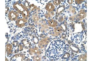 DCXR antibody was used for immunohistochemistry at a concentration of 4-8 ug/ml to stain Epithelial cells of renal tubule (arrows) in Human Kidney. (DCXR Antikörper  (Middle Region))