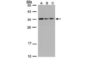 WB Image Sample(30 ug whole cell lysate) A:293T B:A431, C:H1299 12% SDS PAGE antibody diluted at 1:1000 (SARNP Antikörper)