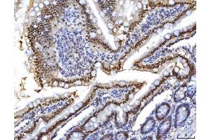 IHC analysis of HNF-4-alpha using anti-HNF-4-alpha antibody (ABIN7600215). (HNF4A Antikörper  (AA 164-474))